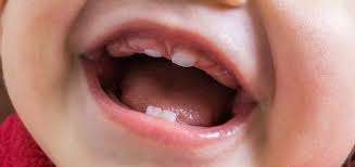Odontopediatria - 7 características imprescindíveis além da especialização